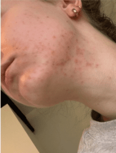 lisa erfaring koreansk hudpleie etter